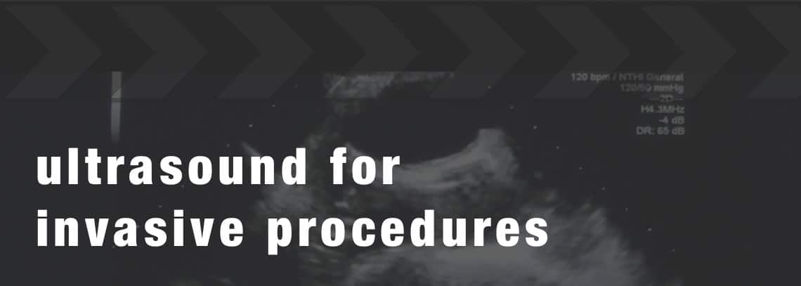 ultrasound invasive procedures