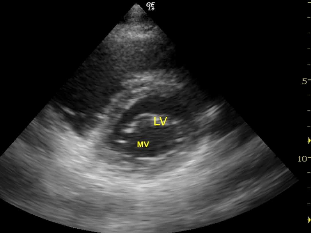 PSAX - LV internal diameter in diastole (LVIDd) is in the normal range. Mitral valve (MV) also indicated