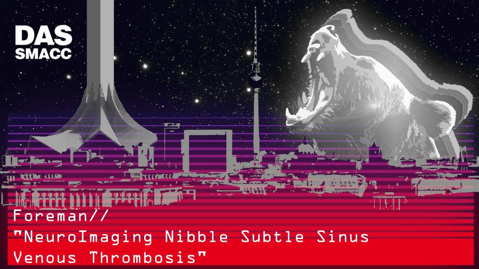 NeuroImaging Nibble Subtle Sinus Venous Thrombosis